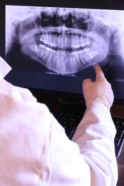 Best Dental Abscess Treatment in Mason, TX