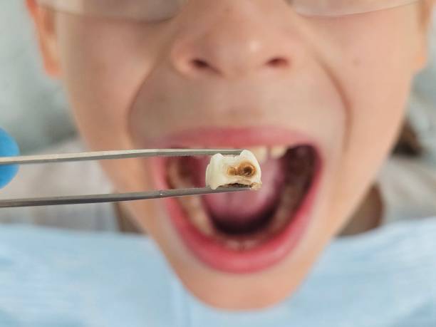 Best Emergency Pediatric Dental Care in Mason, TX