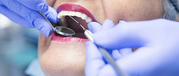 Best Emergency Treatment for Oral Infections in Mason, TX